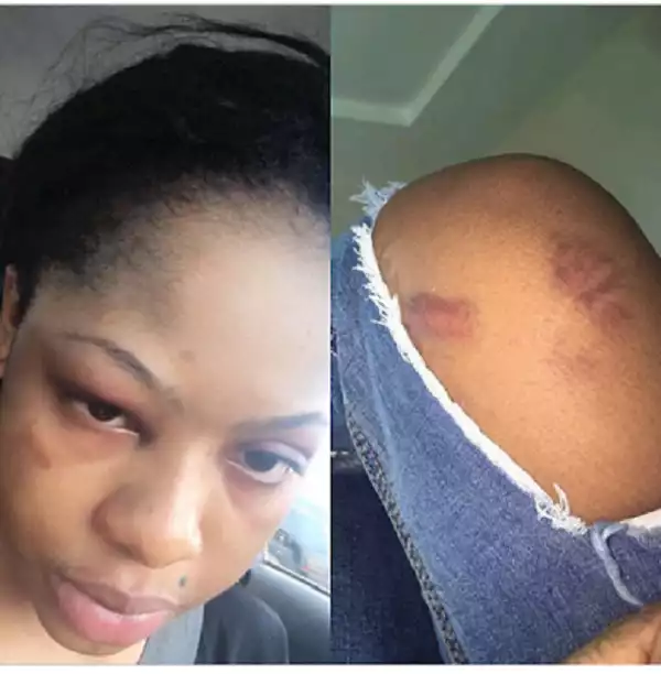 OMG!!! See What Husband Did To Wife Her Offence Will Blow Your Mind
